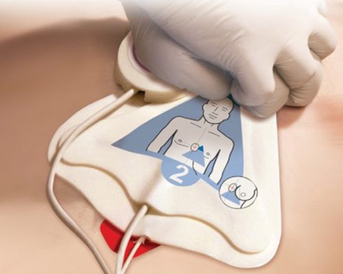 cpr-help2 Sensor RCP Acoplado ao Eletrodo