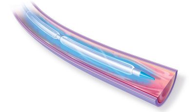 thermogard_como_funciona Thermogard Como Funciona