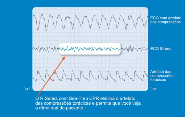 SeeThruCPR SeeThruCPR