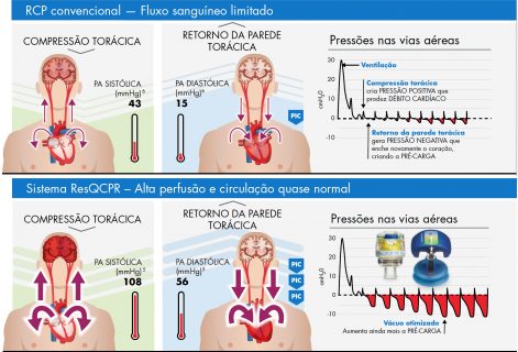 Figura-2-e-3-ResQCPR Figura-2-e-3-ResQCPR